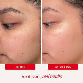 First Aid Beauty pad close-up showing smooth and bumpy dual sides for exfoliation