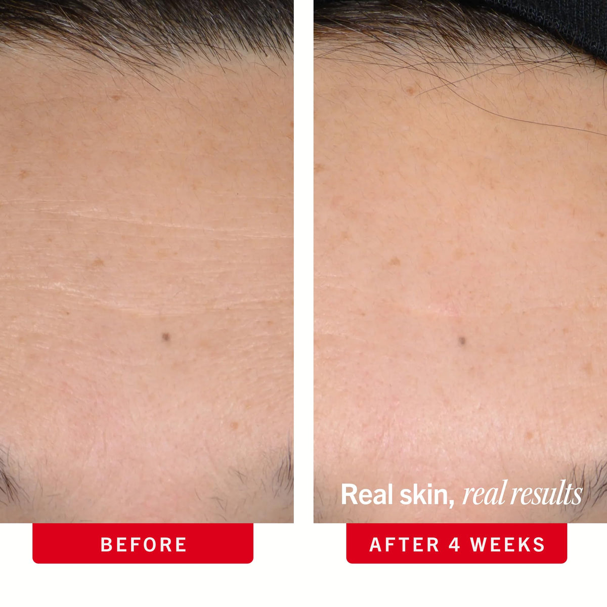 First Aid Beauty ingredients graphic highlighting peptides and retinol complex benefits