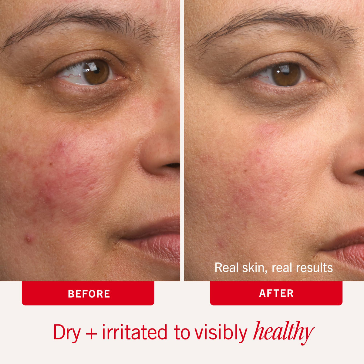 First Aid Beauty open jar with whipped cream highlighting rich, non-greasy feel