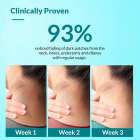 FIXDERMA label close-up listing retinol and lactic acid