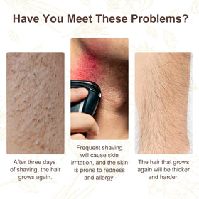 flasture dropper dispensing a drop of oil onto skin, demonstrating easy precise application
