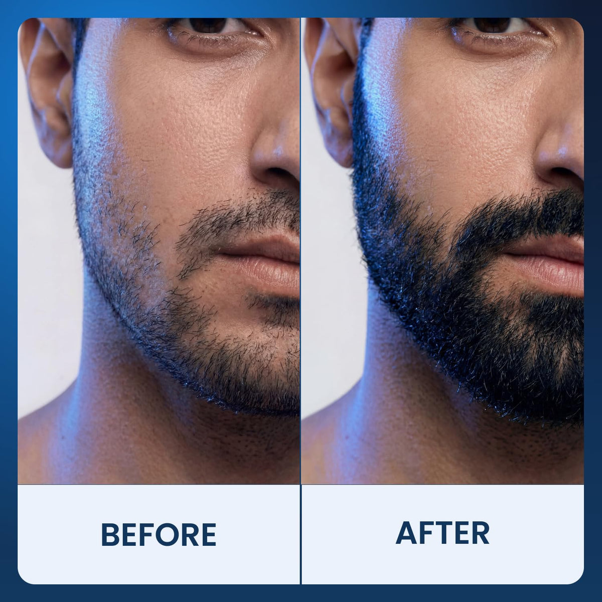 Scale comparison before and after using Fleava indicating fuller-feeling hair benefit