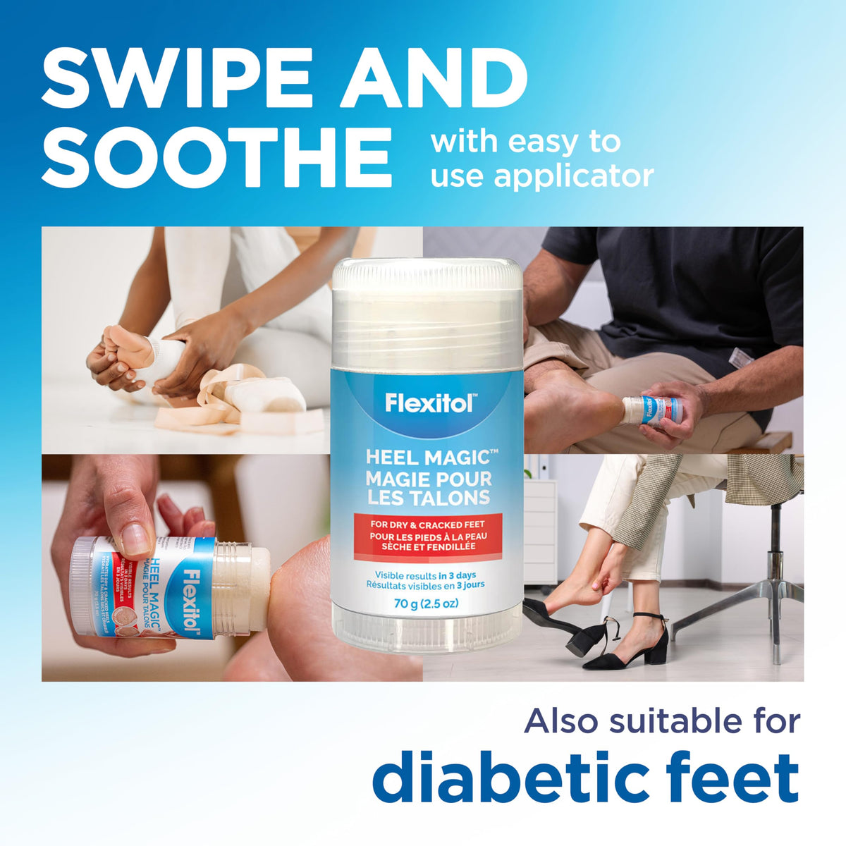 Flexitol applied to heel demonstrating targeted relief