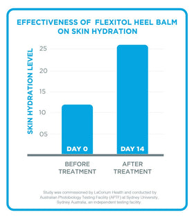 Flexitol-treated feet in sandals showing smooth, confident results
