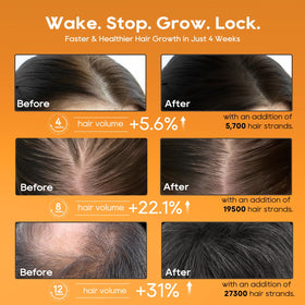 Folivive before and after scale comparison suggesting fuller-looking hair