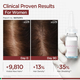 Foltene serum being applied to scalp showing targeted non-greasy delivery