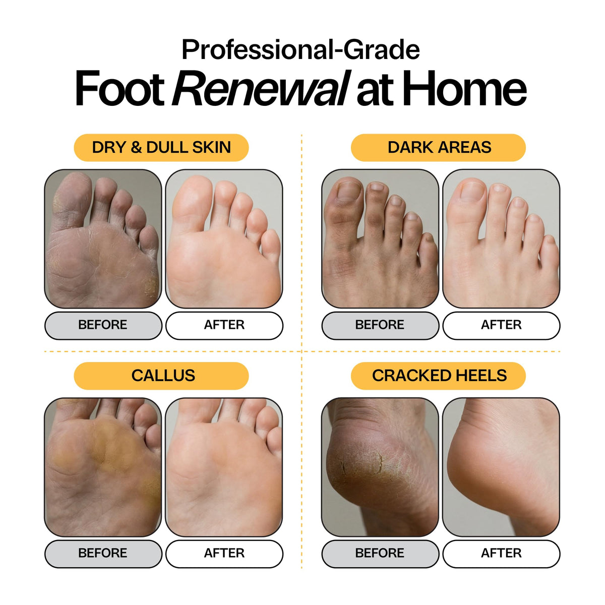 Foot Choice label ingredients detail listing kojic acid niacinamide turmeric