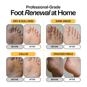 Foot Choice label ingredients detail listing kojic acid niacinamide turmeric