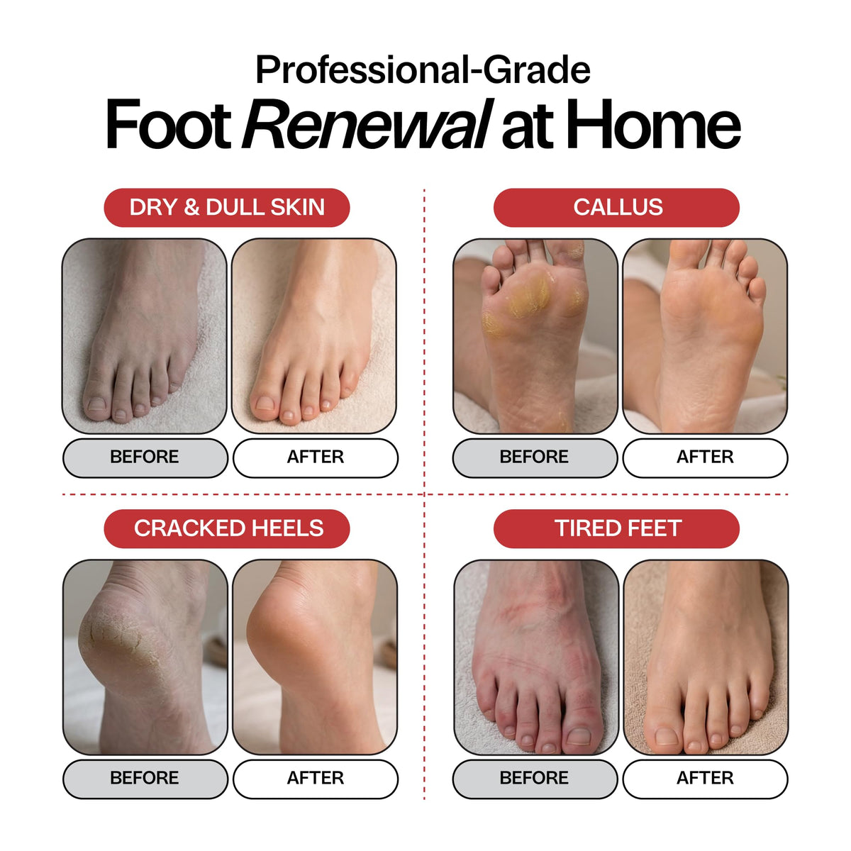 Foot Choice label ingredients panel showing natural botanical list