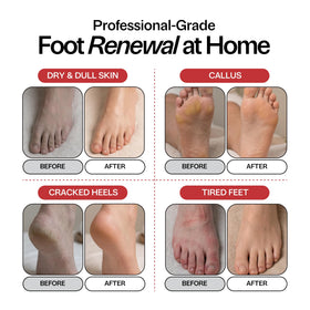Foot Choice label ingredients panel showing natural botanical list