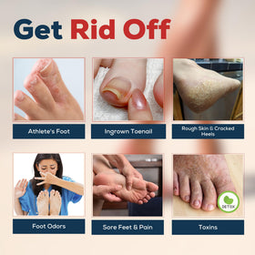 FOOT CURE before and after feet demonstrating softer skin