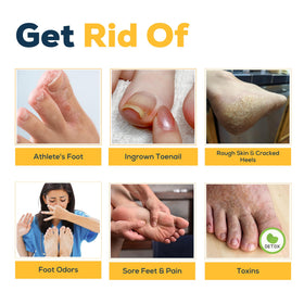 FOOT CURE before and after callus softening visual emphasizing smoother skin