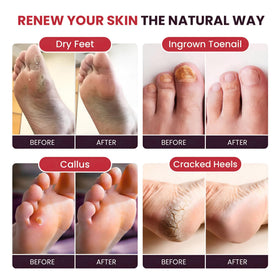 FOOT CURE label detail showing ingredients and natural claim