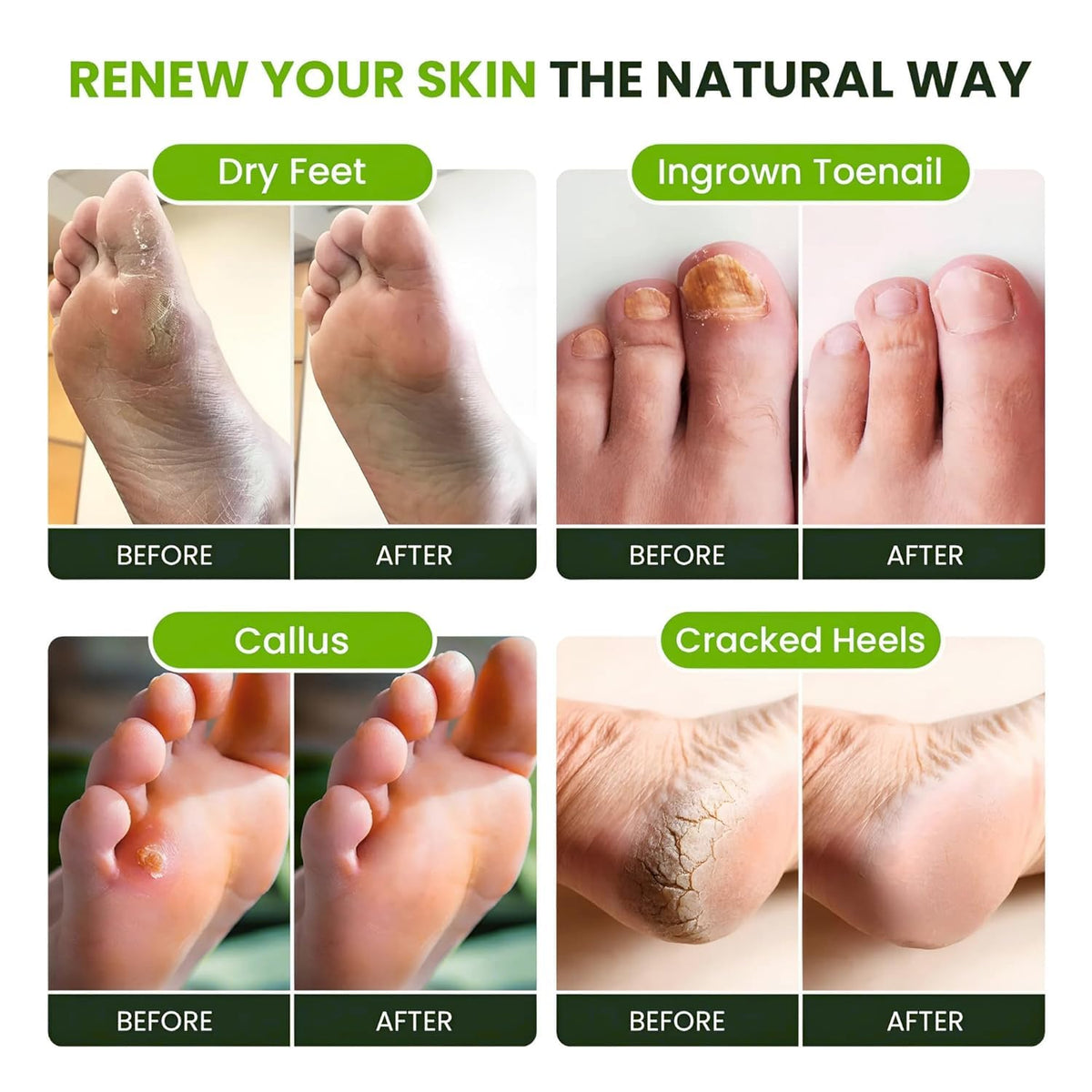FOOT CURE product label showing ingredients and simple directions