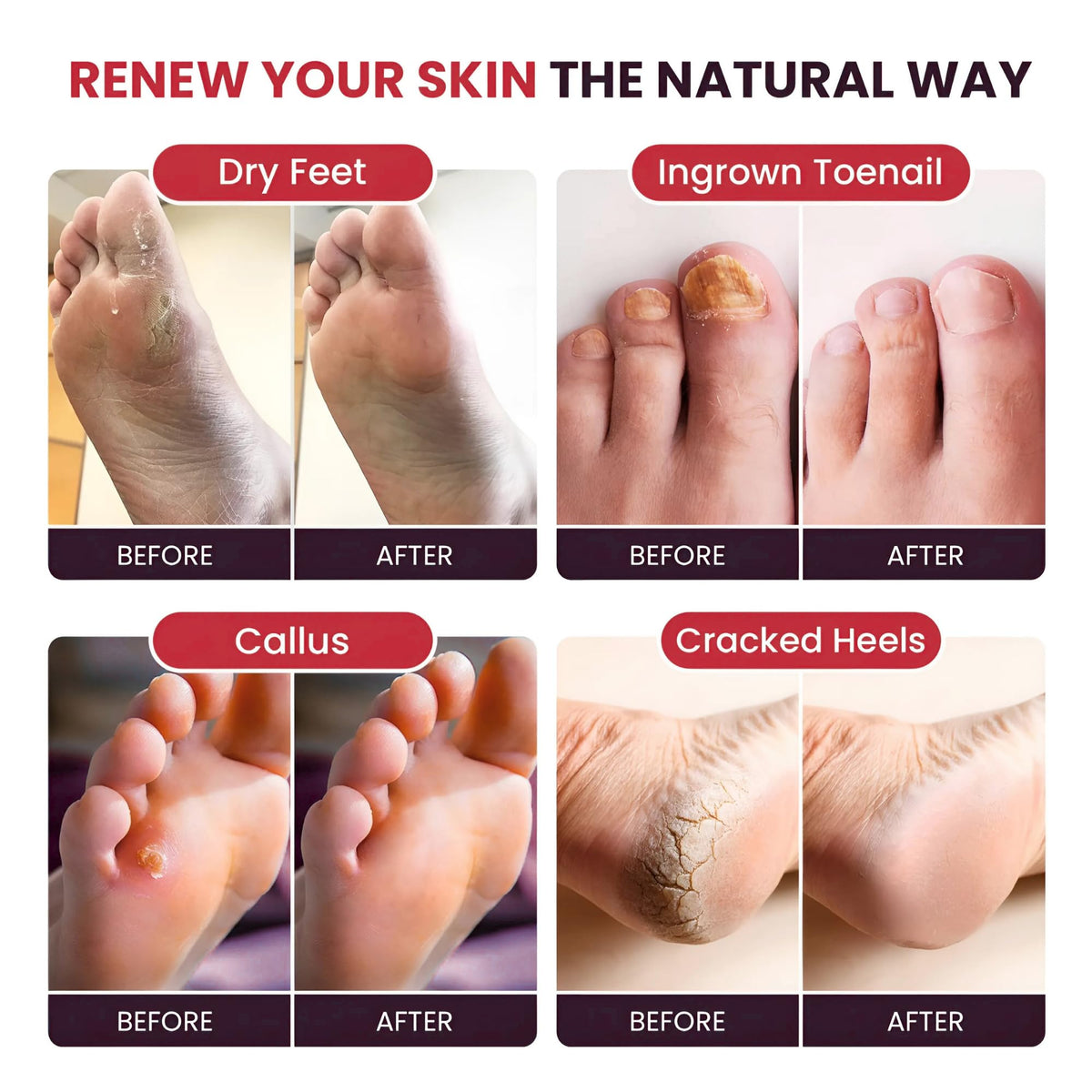 FOOT CURE feet soaking in basin showing relaxing treatment and immediate softness