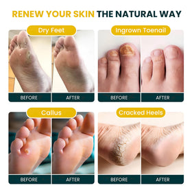 FOOT CURE tea tree and citrus ingredients arranged to show natural fragrance