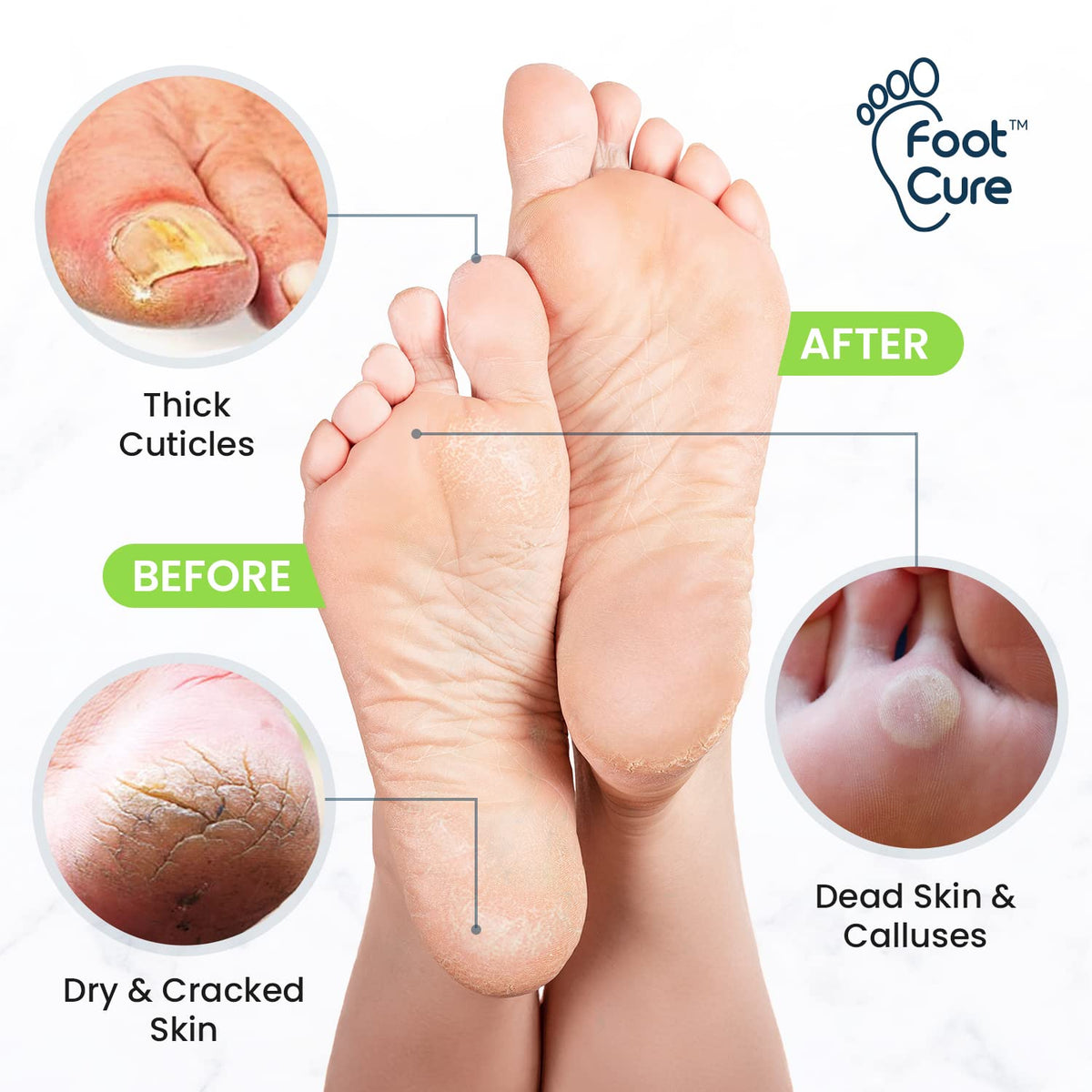 FOOT CURE tea tree soak bottle label displaying natural salts benefit