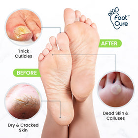 FOOT CURE tea tree soak bottle label displaying natural salts benefit
