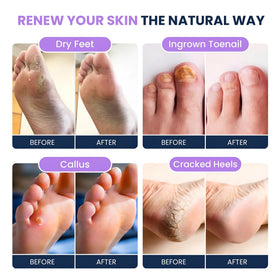 FOOT CURE scrubber texture detail highlighting effective exfoliation