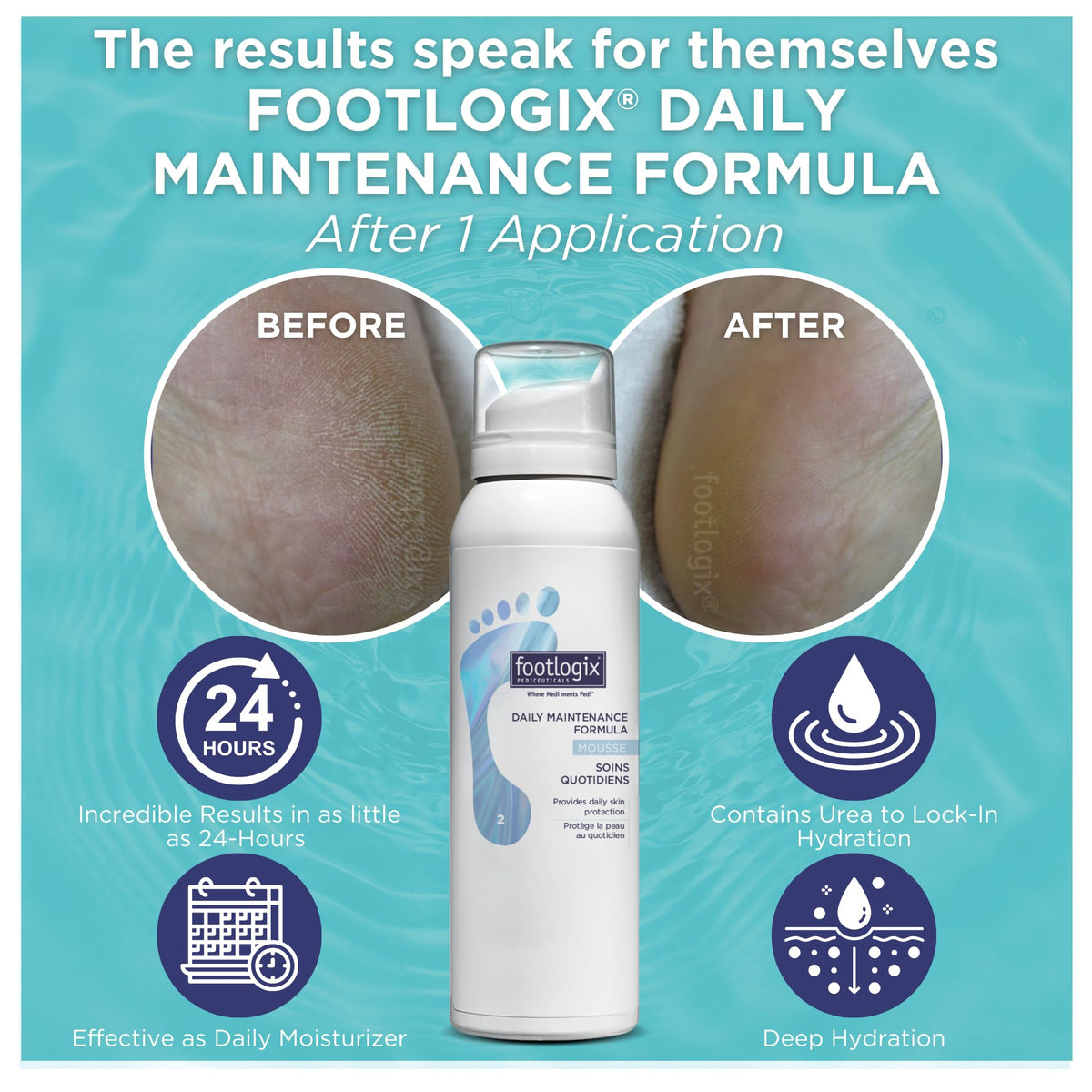 FOOTLOGIX application on heels showing moisturized, softer skin