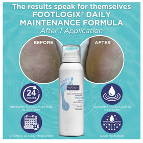 FOOTLOGIX application on heels showing moisturized, softer skin