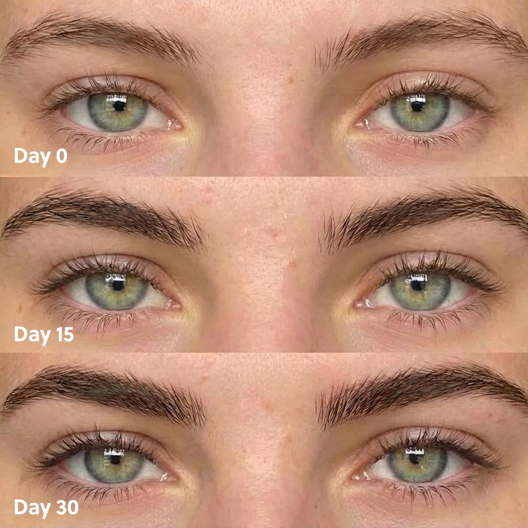 ForChics before and after brow illustration showing visible density improvement