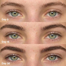 ForChics before and after brow illustration showing visible density improvement