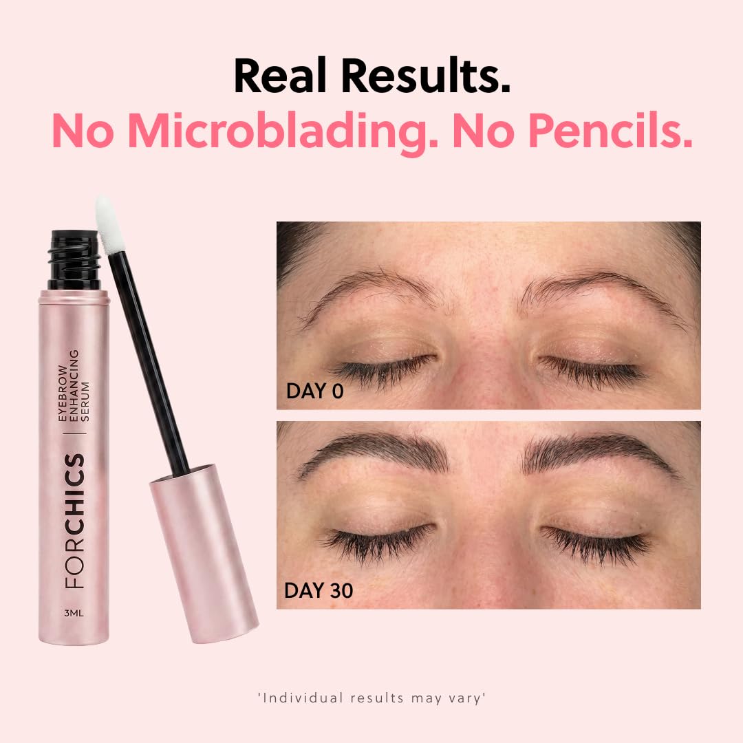 ForChics fine-tip applicator close-up for precise application and effortless control