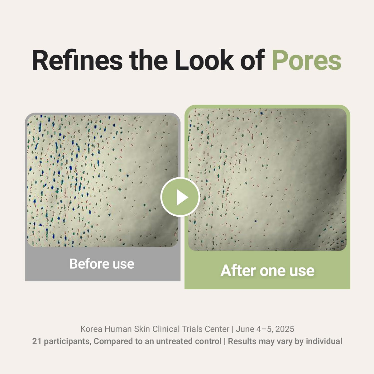 FORETDERM powder transformed to foam for adjustable cleansing
