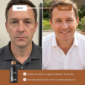 Forge Skin in-use nighttime routine image demonstrating easy topical application
