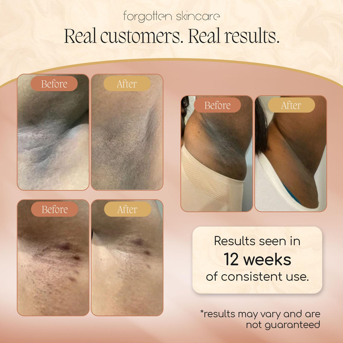 Forgotten Skincare being applied to underarm to control odor and calm skin