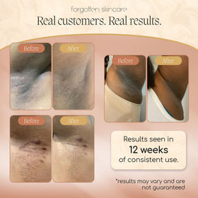 Forgotten Skincare being applied to underarm to control odor and calm skin