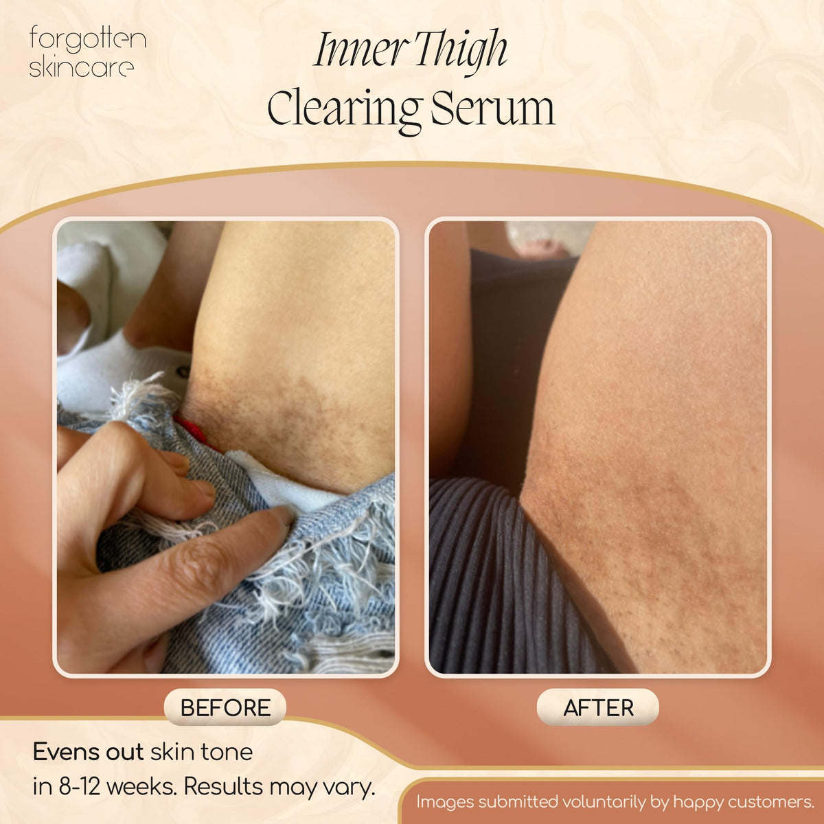 Forgotten Skincare dropper applying serum to fingertip for targeted relief