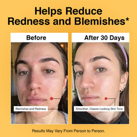 Foundation Skincare cream dispensed on hand demonstrating easy dosing