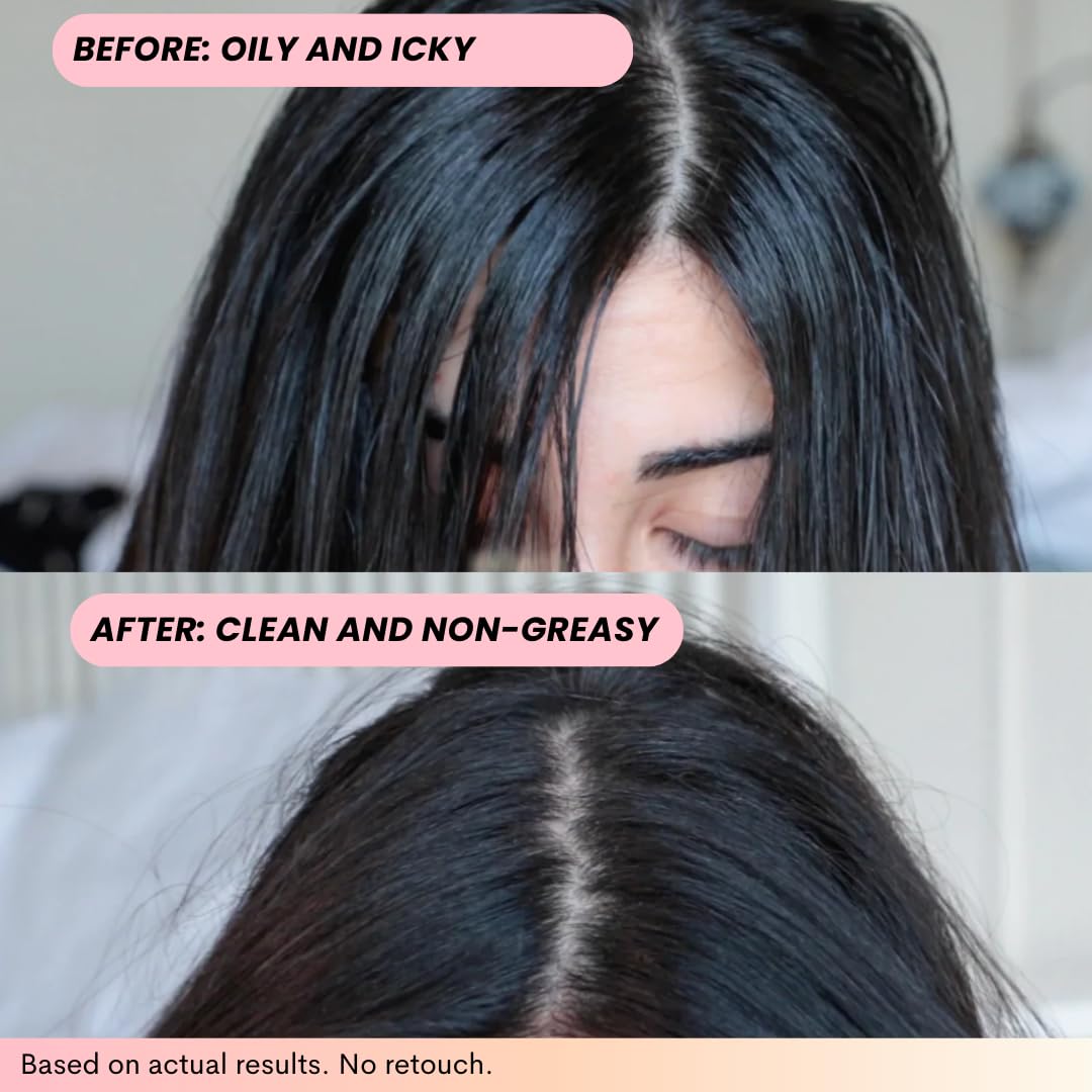 FoxyBae spray texture close-up illustrating lightweight powder that absorbs oil