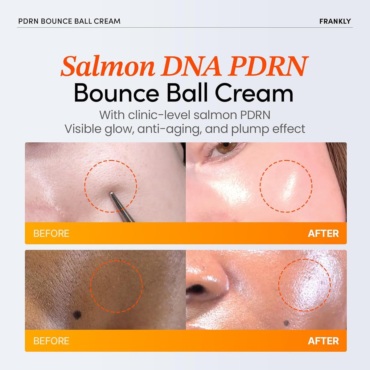 FRANKLY gel-cream texture close-up, lightweight hydration and fast absorption