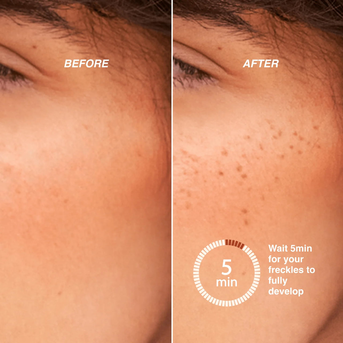 Freck Beauty before and after cheeks showing natural-looking freckle results