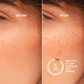 Freck Beauty before and after cheeks showing natural-looking freckle results