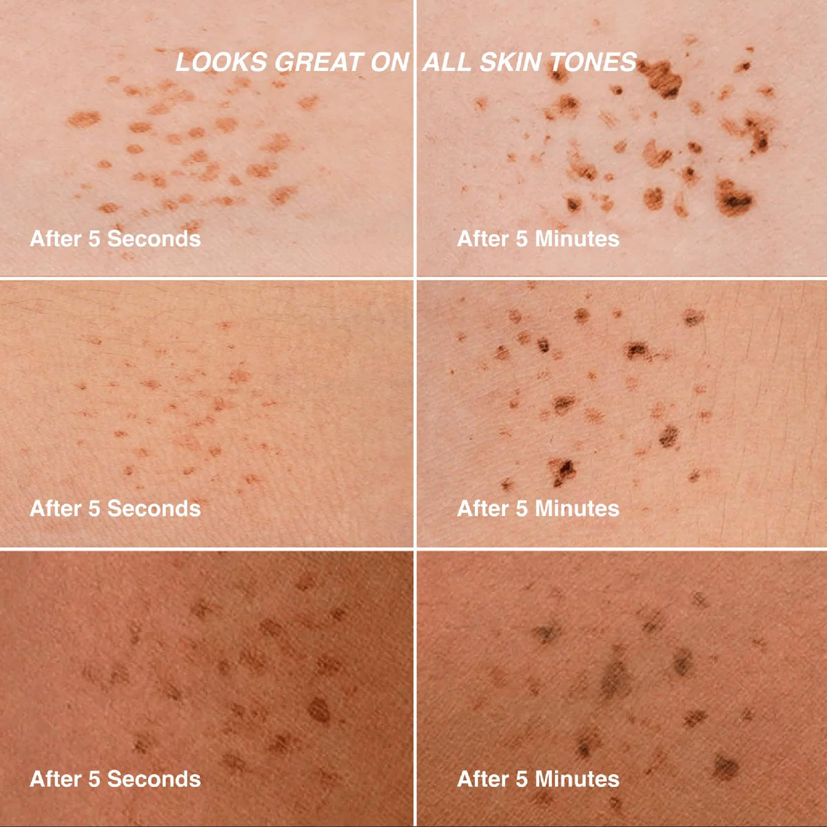 Freck Beauty NOIR before and after cheek demonstrating visible freckle transformation