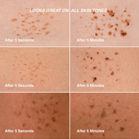 Freck Beauty NOIR before and after cheek demonstrating visible freckle transformation
