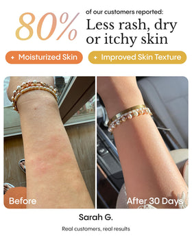 FRØYA balm used as face spot treatment to calm redness