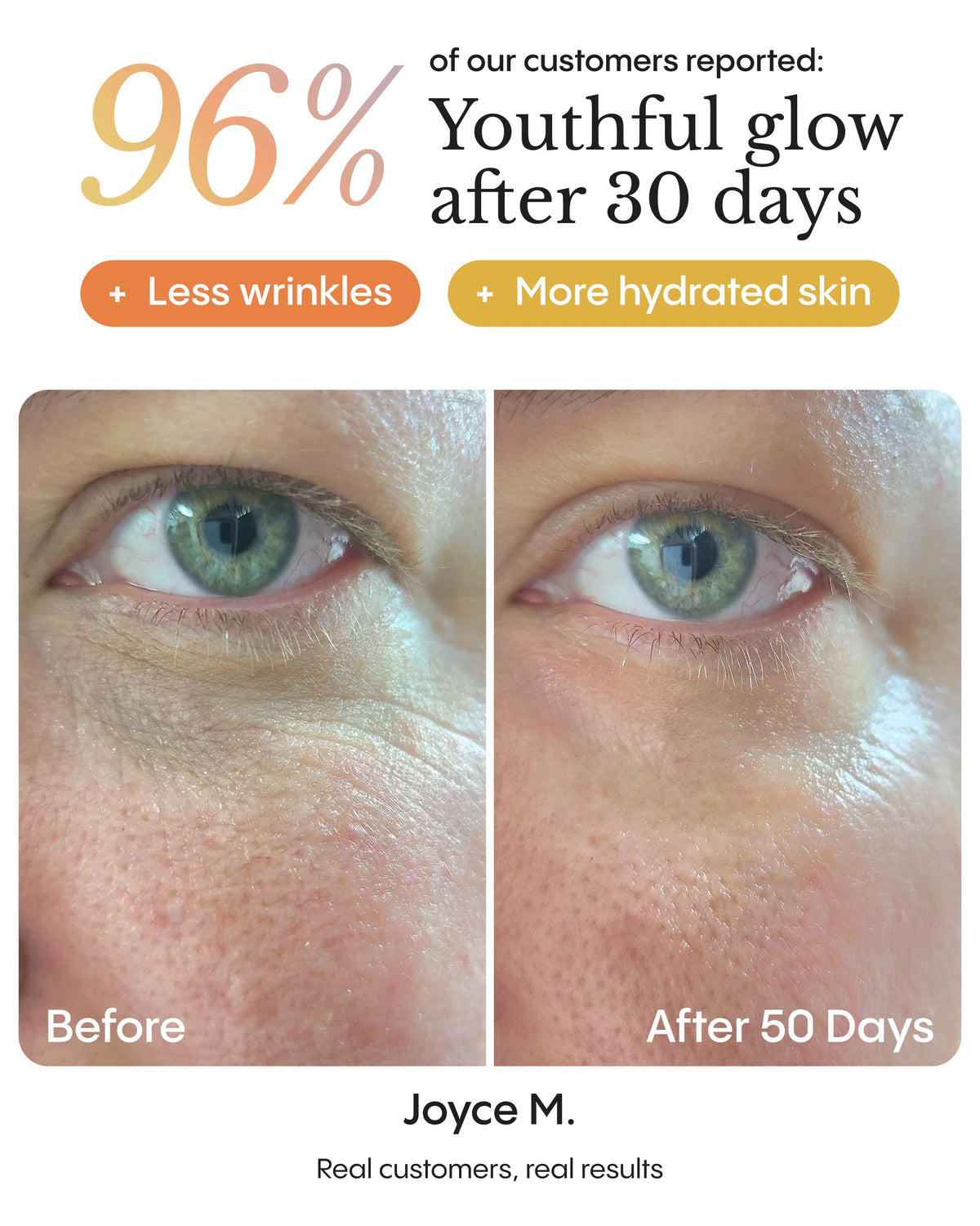 FRØYA beeswax texture macro emphasizing protective, water-free emollient for lasting softness