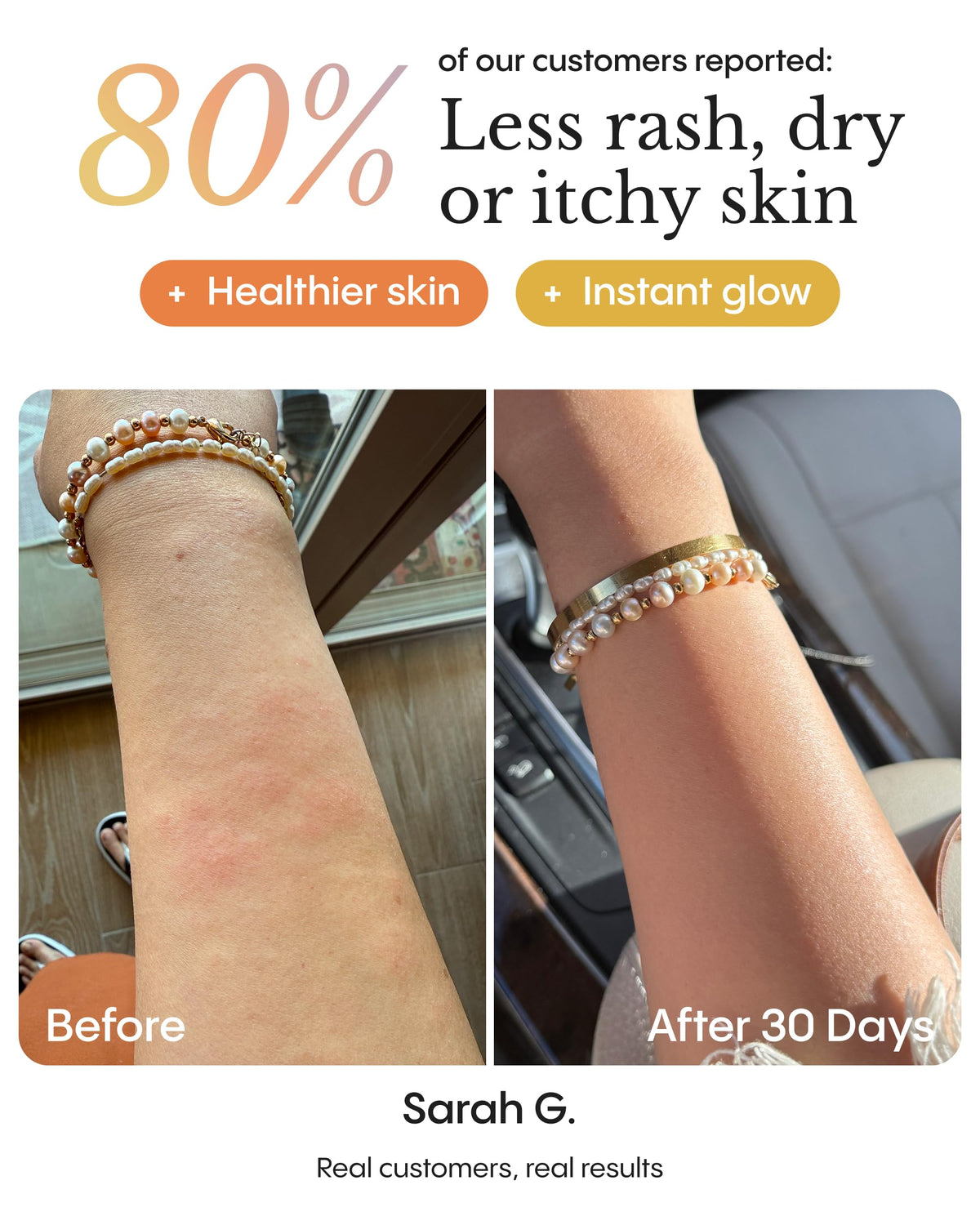 FRØYA hand applying balm to illustrate easy use