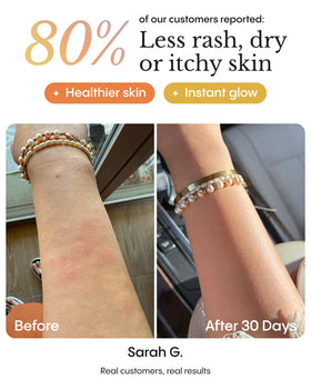 FRØYA hand applying balm to illustrate easy use