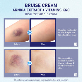 fugit elbow before and after scale demonstrating visual improvement