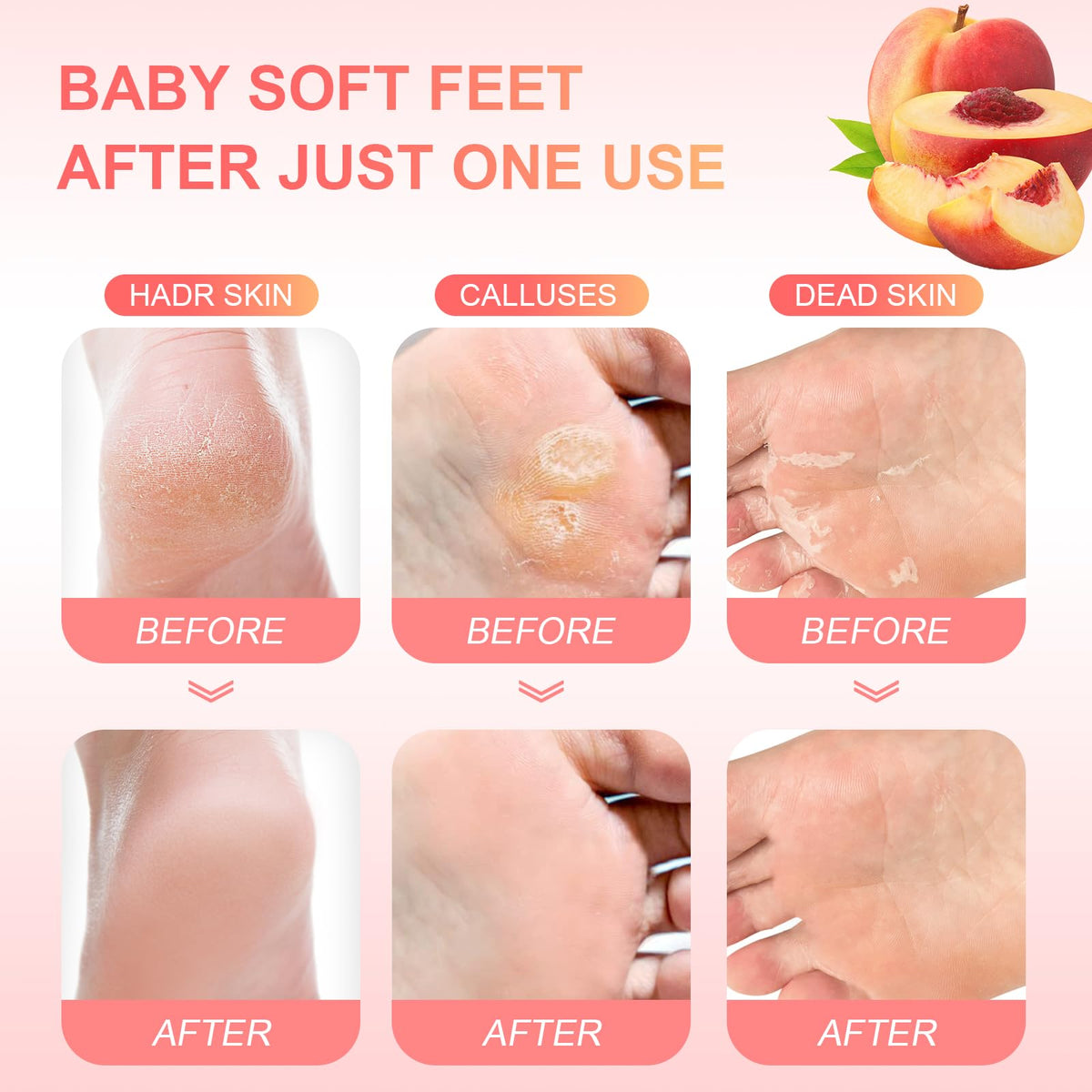 FUNNIR in-use image with booties on feet demonstrating comfort