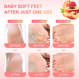 FUNNIR in-use image with booties on feet demonstrating comfort