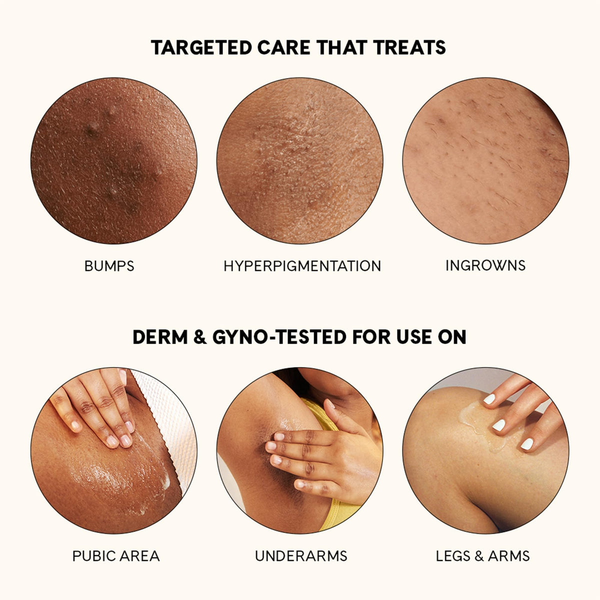 Fur aftercare scene by bikini line showing calmer, smoother skin