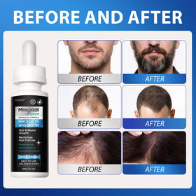 FUZYAT ingredients biotin castor oil collagen blend for nourishment benefit
