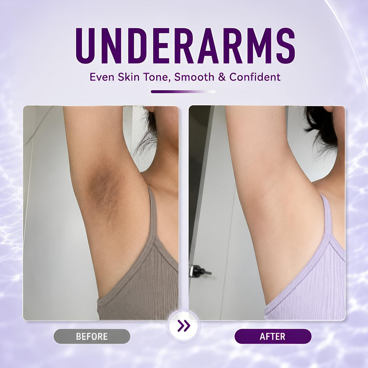 Ganrek being applied to an underarm to even skin tone